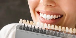Teeth Whitening in Bedok Singapore