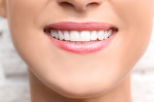 Cosmetic Bonding in Bedok